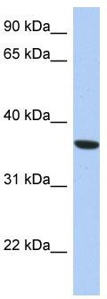 WB Suggested Anti-PSTK Antibody Titration: 0.2-1 ug/ml; ELISA Titer: 1: 12500; Positive Control: THP-1 cell lysate