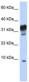 WB Suggested Anti-PXT1 Antibody Titration: 0.2-1 ug/ml; ELISA Titer: 1:312500; Positive Control: Jurkat cell lysate