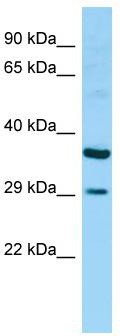 WB Suggested Anti-RAET1G Antibody; Titration: 1.0 ug/ml; Positive Control: Fetal Heart
