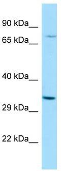 WB Suggested Anti-RASL11A Antibody; Titration: 1.0 ug/ml; Positive Control: MCF7 Whole Cell