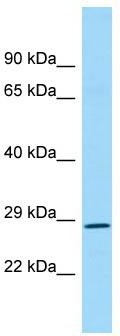 WB Suggested Anti-REP15 Antibody; Titration: 1.0 ug/ml; Positive Control: Fetal Kidney