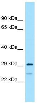 WB Suggested Anti-RPS4Y2 Antibody; Titration: 1.0 ug/ml; Positive Control: 721_B Whole Cell
