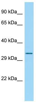 Host: Rabbit; Target Name: RPS4Y2; Sample Tissue: 293T Whole Cell lysates; Antibody Dilution: 1.0 ug/ml