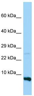 WB Suggested Anti-RPS28 Antibody; Titration: 1.0 ug/ml; Positive Control: MDA-MB-435S Whole Cell RPS28 is strongly supported by BioGPS gene expression data to be expressed in Human MDA-MB435 cells