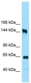WB Suggested Anti-RRP12 Antibody; Titration: 1.0 ug/ml; Positive Control: 293T Whole CellRRP12 is strongly supported by BioGPS gene expression data to be expressed in Human HEK293T cells