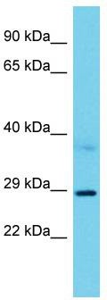 Host: Rabbit; Target Name: RRP15; Sample Tissue: A549 Whole Cell lysates; Antibody Dilution: 1.0ug/ml. RRP15 is supported by BioGPS gene expression data to be expressed in A549
