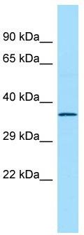 Host: Rabbit; Target Name: Rtcd1; Sample Tissue: Rat Stomach lysates; Antibody Dilution: 1.0 ug/ml