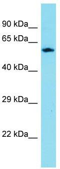 Host: Rabbit; Target Name: CXXC11; Sample Tissue: ACHN Whole cell lysates; Antibody Dilution: 1.0 ug/ml