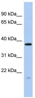 WB Suggested Anti-RWDD2A Antibody Titration: 0.2-1 ug/ml; ELISA Titer: 1: 62500; Positive Control: Human Thymus