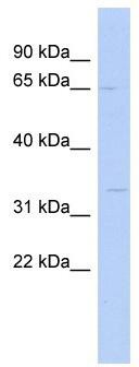 WB Suggested Anti-SC5DL Antibody Titration: 0.2-1 ug/ml; ELISA Titer: 1: 1562500; Positive Control: COLO205 cell lysate