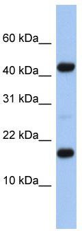 WB Suggested Anti-FLJ37543 Antibody Titration: 0.2-1 ug/ml; ELISA Titer: 1:1562500; Positive Control: Human heart
