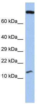 WB Suggested Anti-FLJ37543 Antibody Titration: 0.2-1 ug/ml; ELISA Titer: 1:312500; Positive Control: Human Stomach