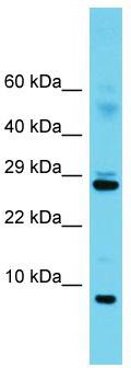 Host: Rabbit; Target Name: Sf3b5; Sample Tissue: Mouse Thymus lysates; Antibody Dilution: 1.0 ug/ml