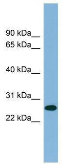 WB Suggested Anti-SRrp35 Antibody Titration: 0.2-1 ug/ml; ELISA Titer: 1: 312500; Positive Control: PANC1 cell lysate