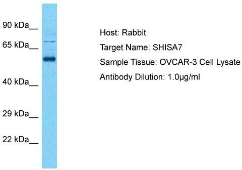 Host: Rabbit; Target Name: SHISA7; Sample Tissue: OVCAR-3 Whole Cell lysates; Antibody Dilution: 1.0ug/ml