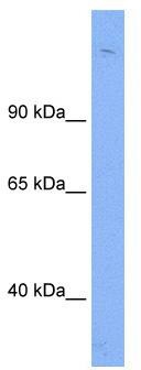 WB Suggested Anti-Sin3b Antibody Titration: 0.2-1 ug/ml; ELISA Titer: 1:1562500; Positive Control: Human Thymus