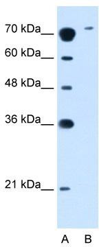 WB Suggested Anti-SLC7A14 Antibody Titration: 2.5 ug/ml; Positive Control: Jurkat cell lysate