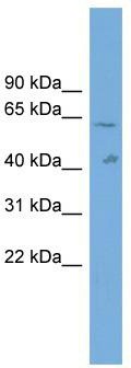 WB Suggested Anti-SLC22A10 Antibody Titration: 0.2-1 ug/ml; ELISA Titer: 1:312500; Positive Control: 293T cell lysate
