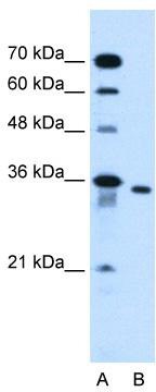 WB Suggested Anti-SLC25A32 Antibody Titration: 0.2-1 ug/ml; Positive Control: HepG2 cell lysate