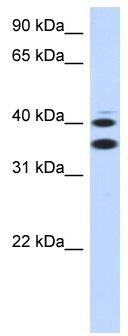 WB Suggested Anti-SLC25A32 Antibody Titration: 0.2-1 ug/ml; ELISA Titer: 1:1562500; Positive Control: Transfected 293T