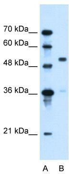 WB Suggested Anti-SLC37A3 Antibody Titration: 0.2-1 ug/ml; Positive Control: HepG2 cell lysate