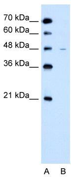 WB Suggested Anti-SLC43A3 Antibody Titration: 2.5 ug/ml; Positive Control: Jurkat cell lysate;SLC43A3 is strongly supported by BioGPS gene expression data to be expressed in Human Jurkat cells