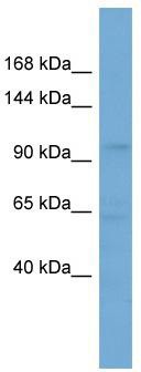 WB Suggested Anti-SLCO5A1 Antibody Titration: 0.2-1 ug/ml; ELISA Titer: 1:312500; Positive Control: HepG2 cell lysate