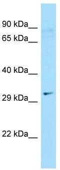 WB Suggested Anti-C9orf24 Antibody; Titration: 1.0 ug/ml; Positive Control: Hela Whole cell