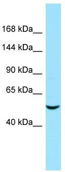 Host: Rabbit; Target Name: ARHGEF40; Sample Tissue: COLO205 Whole Cell lysates; Antibody Dilution: 1.0 ug/ml