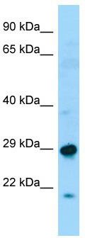WB Suggested Anti-SPAG7 Antibody; Titration: 1.0 ug/ml; Positive Control: Fetal Liver
