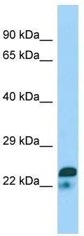 WB Suggested Anti-SPIN2A Antibody; Titration: 1.0 ug/ml; Positive Control: Jurkat Whole Cell