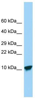 Host: Rabbit; Target Name: SPINK9; Sample Tissue: Placenta lysates; Antibody Dilution: 1.0 ug/ml