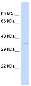 Host: Rabbit; Target Name: SPPL2B; Sample Tissue: 293T Whole cell lysates; Antibody Dilution: 1.0 ug/ml