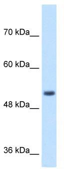 WB Suggested Anti-SPPL2B Antibody Titration: 1 ug/ml; Positive Control: Jurkat cell lysate;SPPL2B is supported by BioGPS gene expression data to be expressed in Jurkat