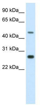WB Suggested Anti-SPZ1 Antibody Titration: 2.5 ug/ml; ELISA Titer: 1:312500; Positive Control: NIH/3T3 cell lysate