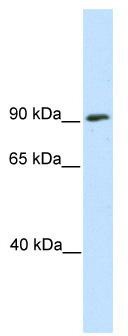 WB Suggested Anti-SREBF1 Antibody Titration: 0.2-1 ug/ml; ELISA Titer: 1:62500; Positive Control: SP2/0 cell lysate