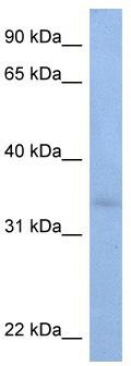 WB Suggested Anti-ST6GALNAC3 Antibody Titration: 0.2-1 ug/ml; Positive Control: HepG2 cell lysate