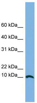 WB Suggested Anti-STRA13 Antibody Titration: 0.2-1 ug/ml; ELISA Titer: 1: 1562500; Positive Control: A549 cell lysate