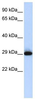 WB Suggested Anti-SUSD3 Antibody Titration: 0.2-1 ug/ml; ELISA Titer: 1: 12500; Positive Control: Human Placenta