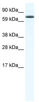 WB Suggested Anti-FOXO6 Antibody Titration: 1.25ug/ml; ELISA Titer: 1:62500; Positive Control: SP2/0 cell lysate