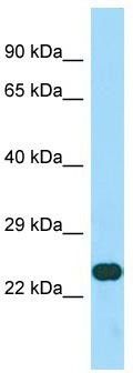 Host: Rabbit; Target Name: CCDC59; Sample Tissue: HepG2 Whole Cell lysates; Antibody Dilution: 1.0ug/ml