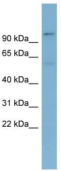 WB Suggested Anti-TBL3 Antibody Titration: 0.2-1 ug/ml; ELISA Titer: 1: 12500; Positive Control: ACHN cell lysateTBL3 is supported by BioGPS gene expression data to be expressed in ACHN