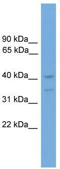 WB Suggested Anti-Foxq1 Antibody Titration: 0.2-1 ug/ml; Positive Control: Mouse Brain