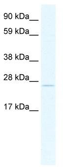 WB Suggested Anti-TCF23 Antibody Titration: 2.5ug/ml; ELISA Titer: 1:62500; Positive Control: SP2/0 cell lysate