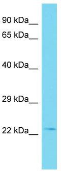 Host: Rabbit; Target Name: TEX38; Sample Tissue: Hela Whole cell lysates; Antibody Dilution: 1.0 ug/ml