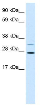 WB Suggested Anti-FSBP Antibody Titration: 1.25ug/ml; Positive Control: Human Stomach