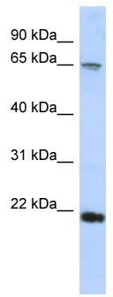 WB Suggested Anti-FSBP Antibody Titration: 0.2-1 ug/ml; ELISA Titer: 1:62500; Positive Control: HepG2 cell lysate