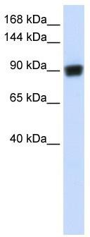 WB Suggested Anti-RAD54B Antibody Titration: 0.2-1 ug/ml; ELISA Titer: 1:312500; Positive Control: Human brain