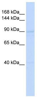 WB Suggested Anti-RAD54B Antibody Titration: 0.2-1 ug/ml; ELISA Titer: 1:1562500; Positive Control: Hela cell lysateRAD54B is supported by BioGPS gene expression data to be expressed in HeLa