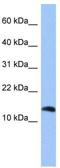 WB Suggested Anti-PTH2 Antibody Titration: 0.2-1 ug/ml; Positive Control: HepG2 cell lysate